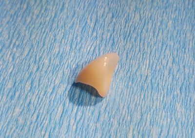 フルジルコニア