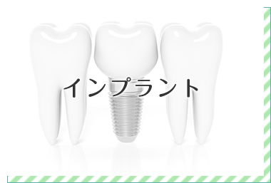インプラント
